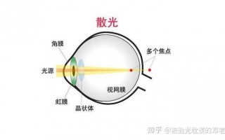 怎么样 散光，怎么样散光不增加太快